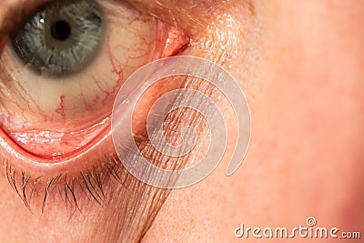 The manâ€™s eye is gray-blue with red veins on it very close Stock Photo